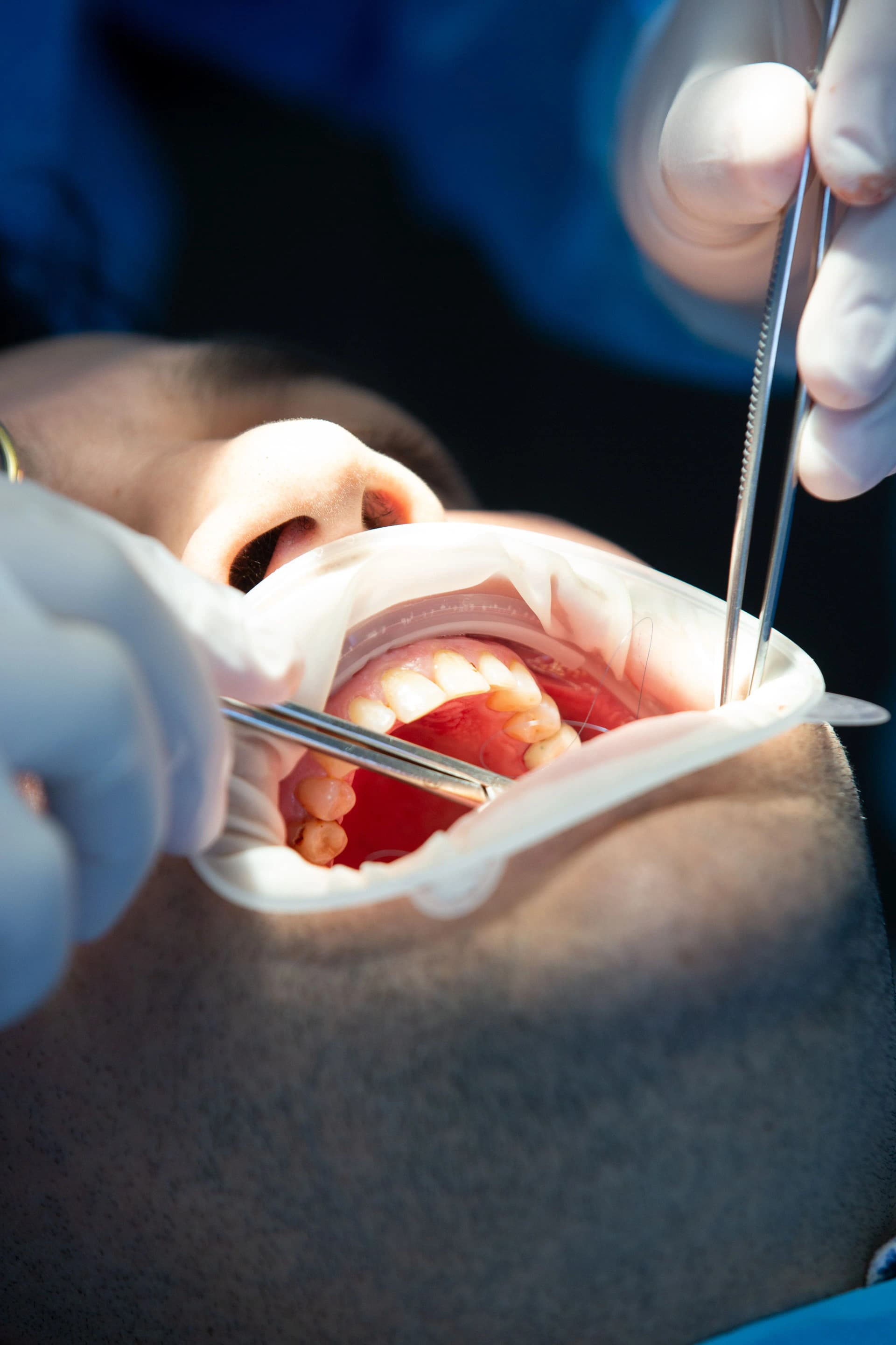 Periodontal Gum Care